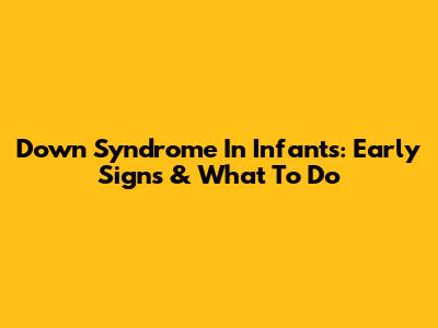 Down Syndrome In Infants: Early Signs & What To Do