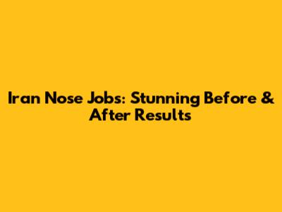 Iran Nose Jobs: Stunning Before & After Results