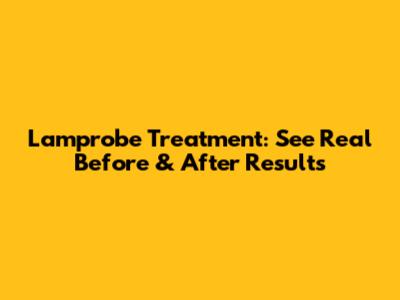 Lamprobe Treatment: See Real Before & After Results