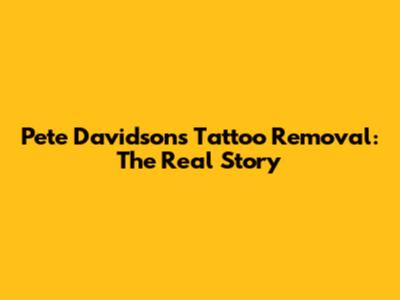 Pete Davidson's Tattoo Removal: The Real Story