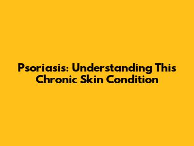 Psoriasis: Understanding This Chronic Skin Condition